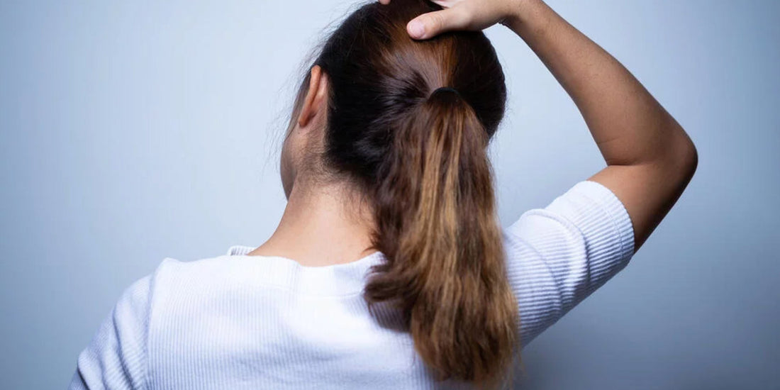 Scalp acne - yes, it's definitely a thing!