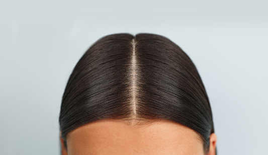 3 common scalp concerns explained